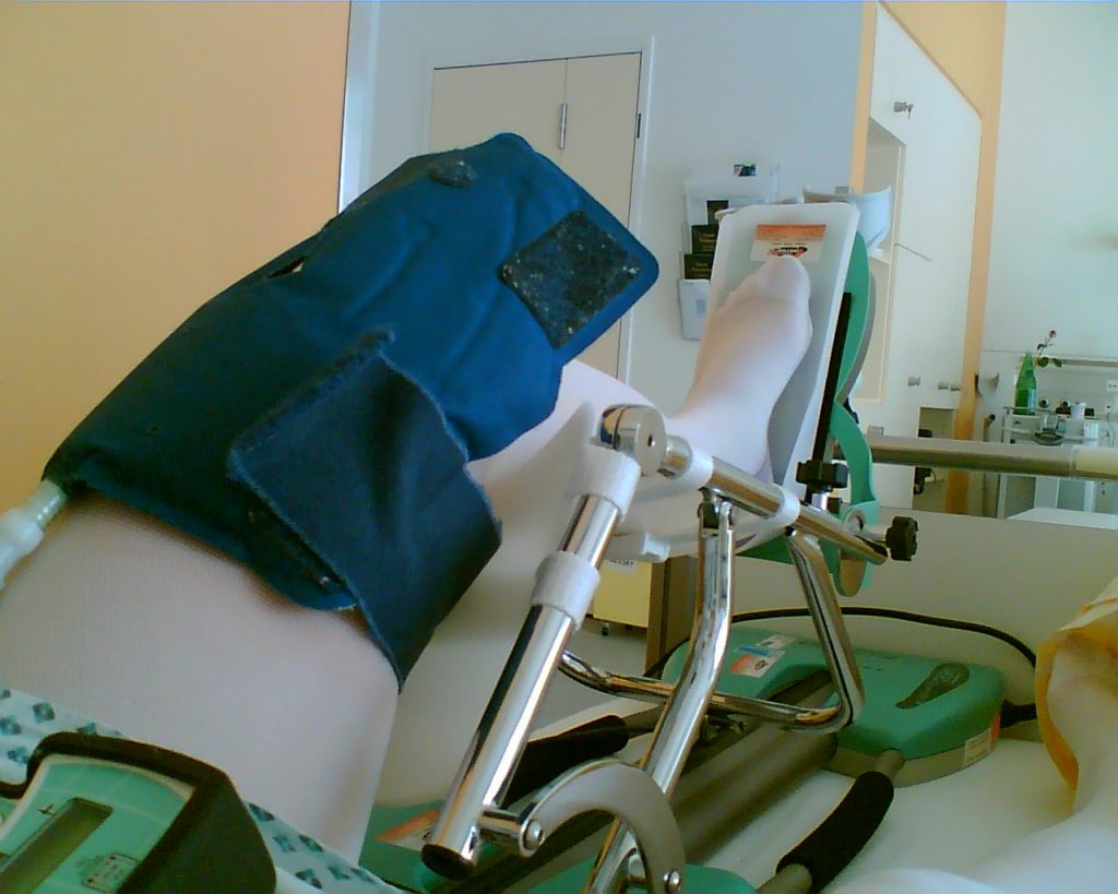 Linkes Bein nach einer Operation auf Maschine zum passiven Abwinkeln des Kniegelenks.